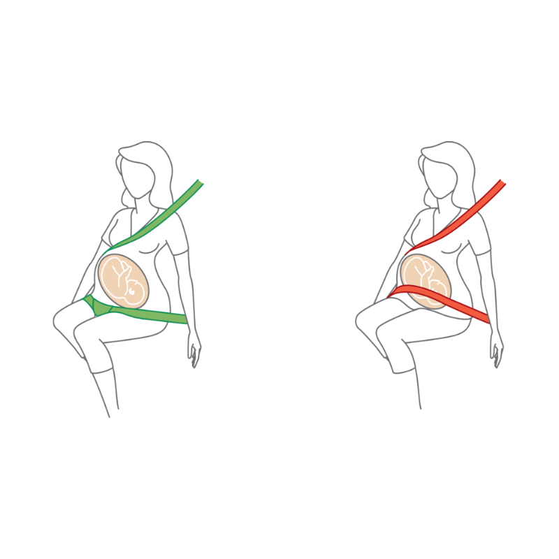 Illustration einer schwangeren Person: links zeigt ein grüner Gurt die korrekte Sitzposition mit Beckengurt unter dem Bauch, rechts zeigt ein roter Gurt die falsche Position über dem Bauch.